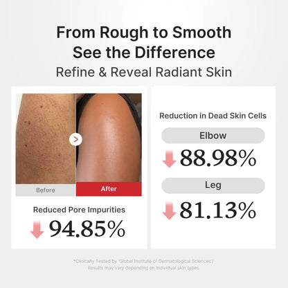 [GIFT] Hypochlorous Acid Rice Body Peel Shot
