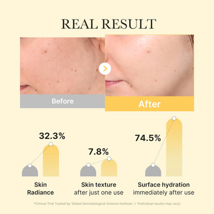 [Subscr.] Kojic Acid Turmeric Gold Jelly Gel Mask