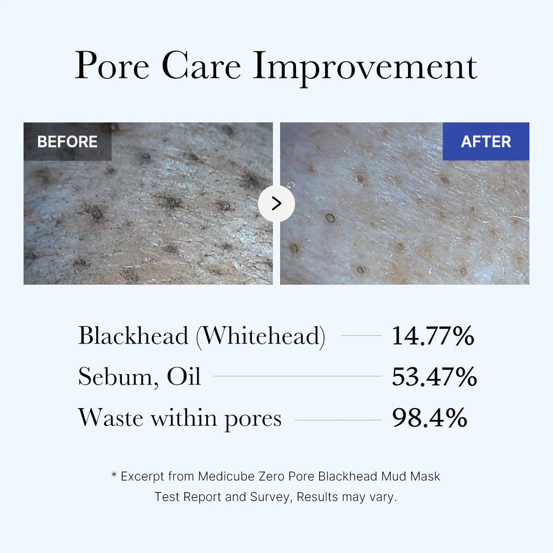[GIFT] Zero Pore Blackhead Mud Mask