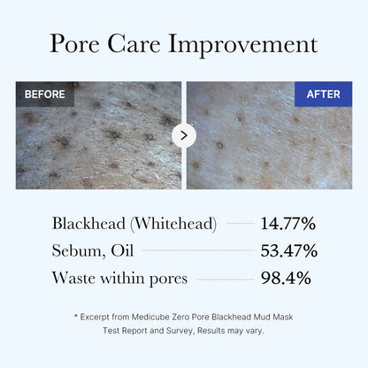 [GIFT] Zero Pore Blackhead Mud Mask