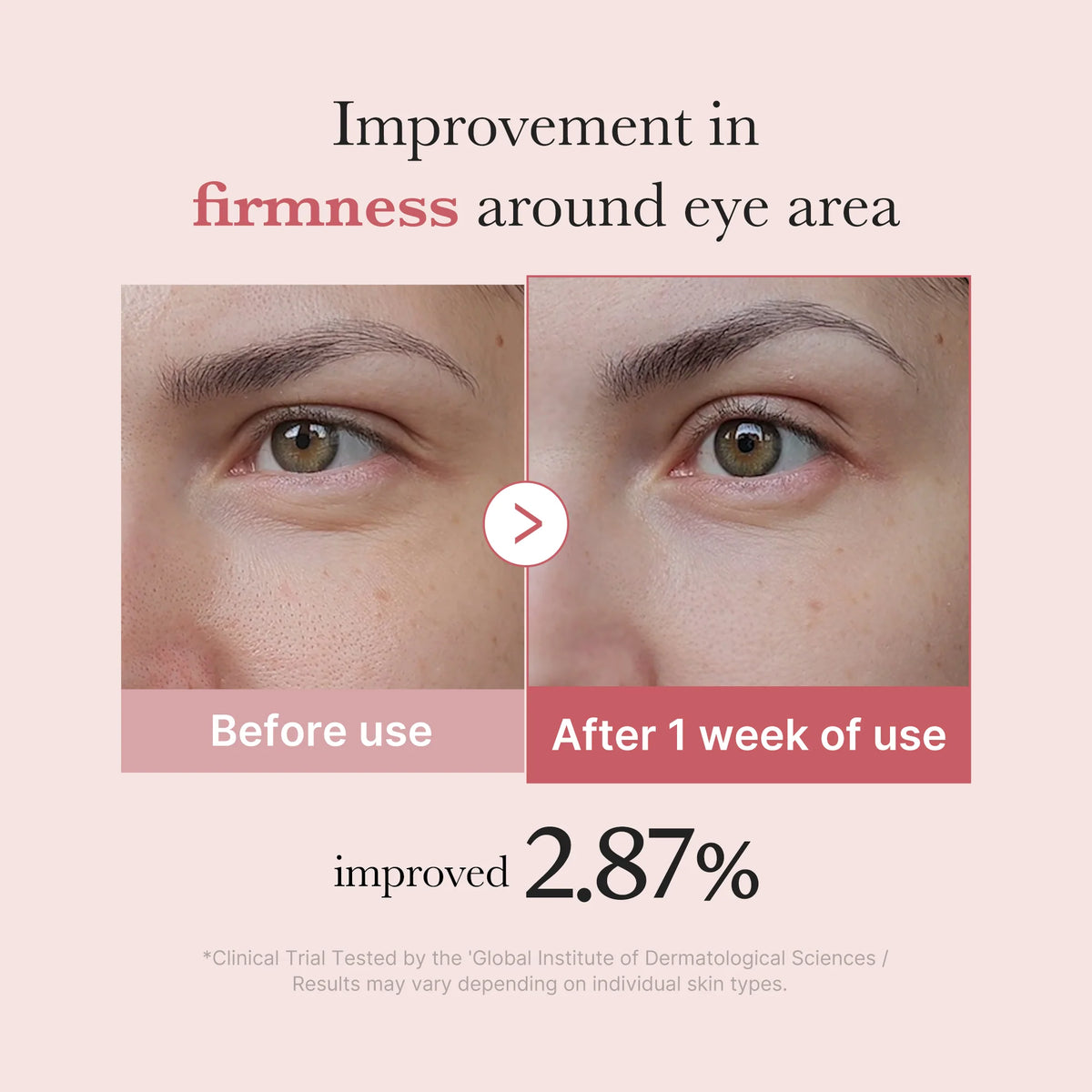 [Subscr.] PDRN Pink Peptide Eye Cream