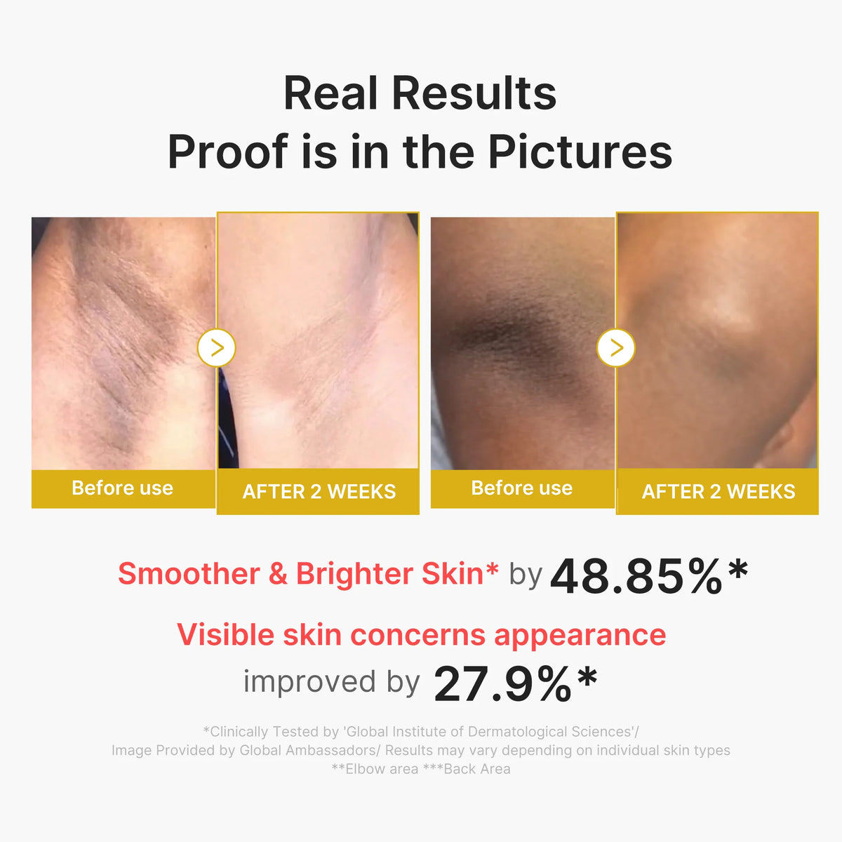 Kojic Acid Turmeric Body Peel Shot
